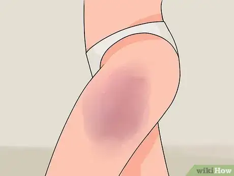 Image intitulée Take an Inch off Your Thighs Step 15