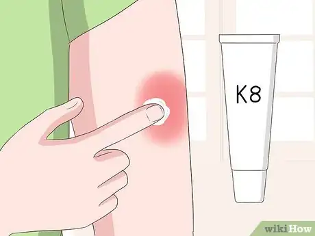 Image intitulée Make a Bruise Go Away Faster Step 20