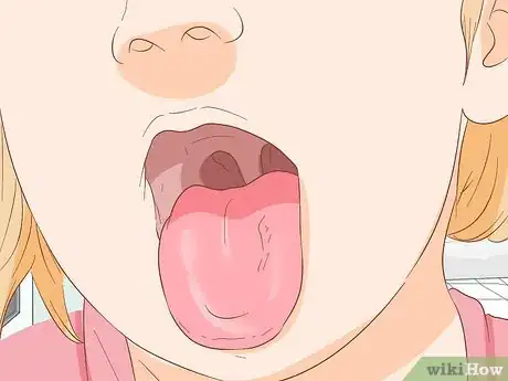 Image intitulée Stop Tongue Bleeding Step 11