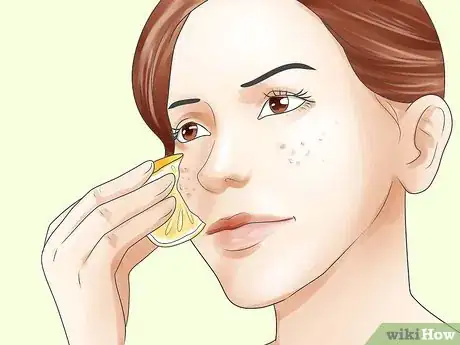 Image intitulée Get Rid of Brown Spots Using Home Remedies Step 1