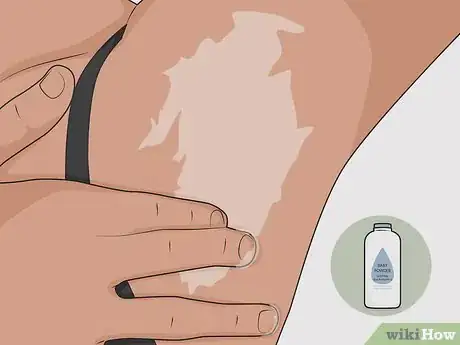 Image intitulée Heal Armpit Rash Step 12