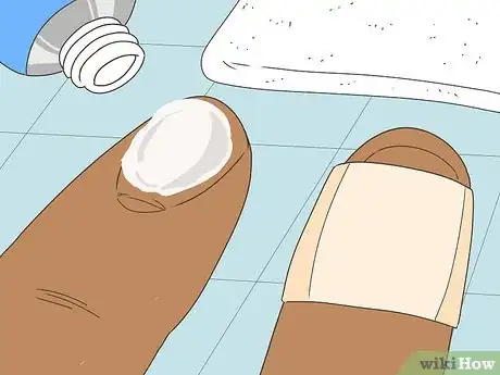 Image intitulée Remove a Splinter Under Your Fingernail Step 5