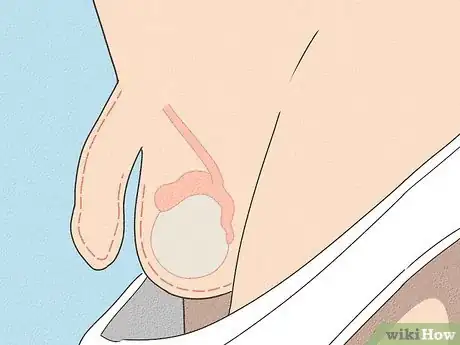 Image intitulée Tell if You Have Hit Puberty (Boys) Step 3