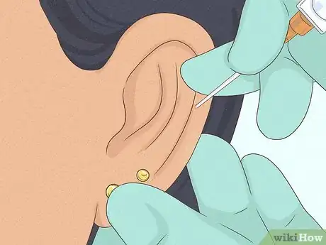 Image intitulée Is It Safe to Pierce Your Own Cartilage Step 2