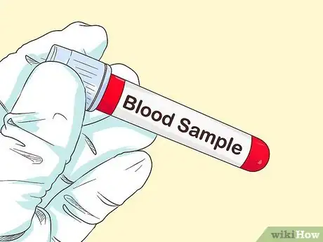 Image intitulée Diagnose Meningitis Step 5