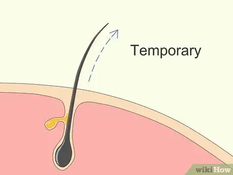 Image intitulée Use Minoxidil (Rogaine) Step 7