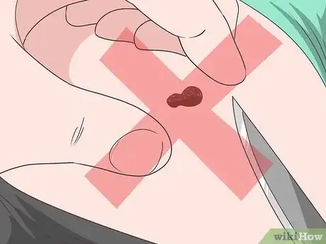 Image intitulée Stop a Mole from Bleeding Step 10
