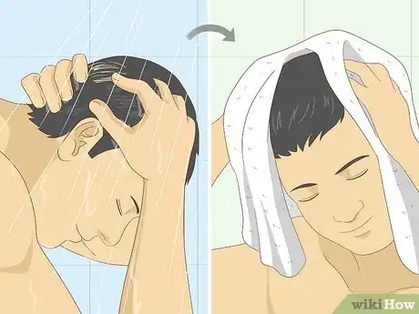 Image intitulée Use Minoxidil (Rogaine) Step 1