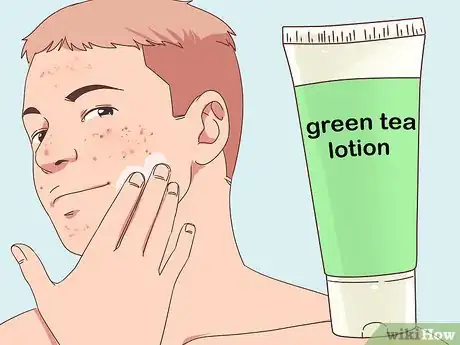 Image intitulée Reduce Sebum Production Step 11