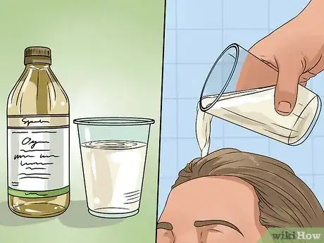 Image intitulée Remove Dandruff Using Vinegar Step 2