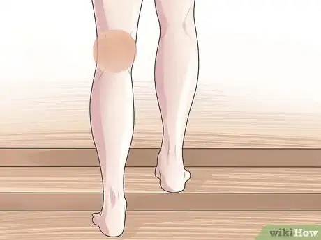 Image intitulée Know if You Have a Baker's Cyst Step 4