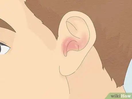 Image intitulée Remove a Bug from Your Ear Step 13