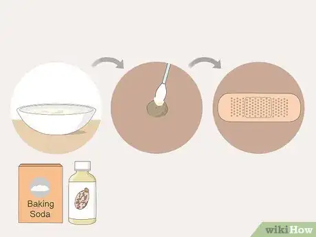 Image intitulée Get Rid of Warts Step 33