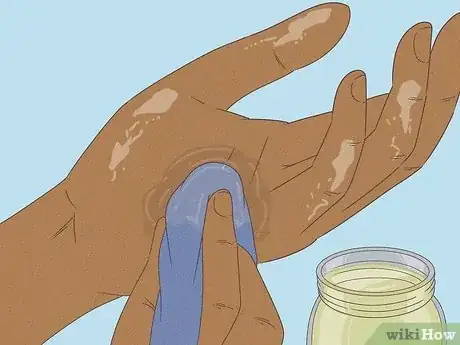 Image intitulée Get Spray Foam Off Hands Step 9