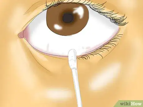 Image intitulée Get Dirt Out of Your Eye Step 5