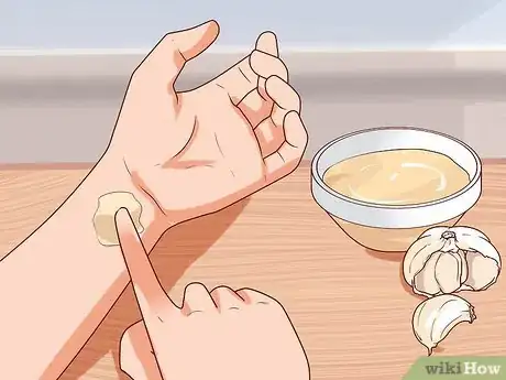 Image intitulée Remove Warts Naturally Using Garlic Step 1