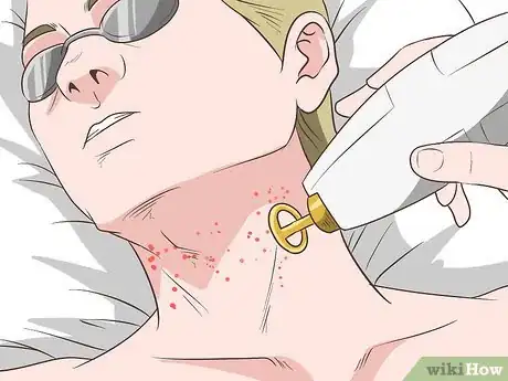 Image intitulée Get Rid of Neck Acne Step 23