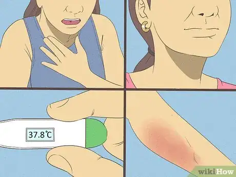 Image intitulée Get Rid of a Rash Step 12