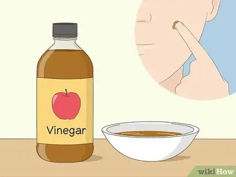 Image intitulée Get Rid of Moles on Your Face Step 16