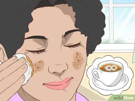 Image intitulée Quickly Heal Open Sores on Your Face Step 19