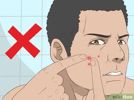 Image intitulée Quickly Heal Open Sores on Your Face Step 13