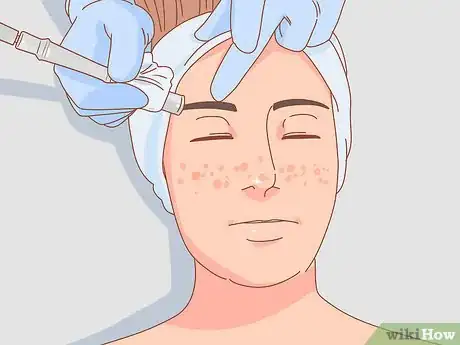 Image intitulée Get Rid of Dark Spots Step 12