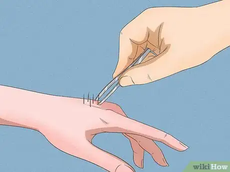 Image intitulée Remove Cactus Needles Step 1