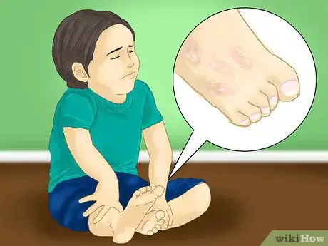 Image intitulée Treat Foot Pain in Children Step 3