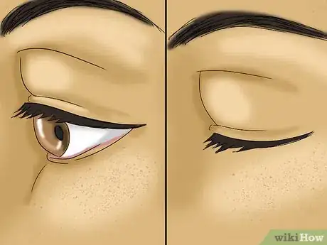 Image intitulée Get Dirt Out of Your Eye Step 1