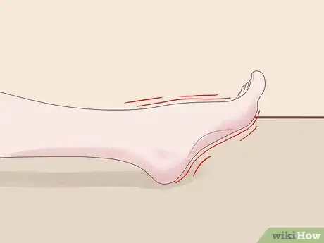 Image intitulée Know if Your Have Neuropathy in Your Feet Step 6