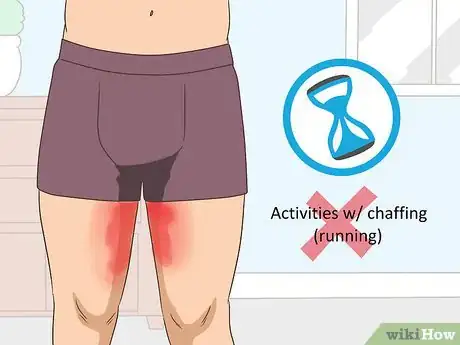 Image intitulée Prevent Chafing Between Your Legs Step 10