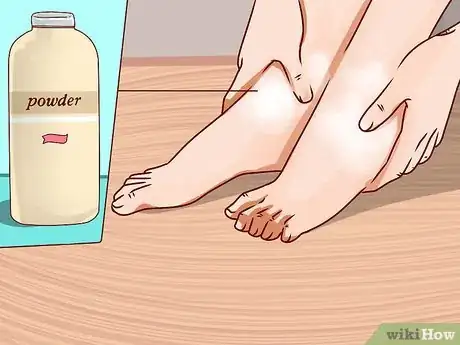 Image intitulée Treat Trench Foot Step 11