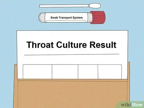 Image intitulée Differentiate Bacterial Tonsillitis and Viral Tonsillitis Step 13