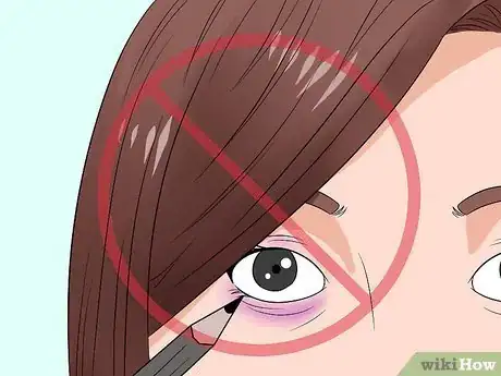 Image intitulée Treat a Black Eye Step 12