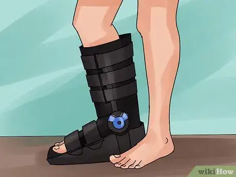 Image intitulée Fake an Ankle Sprain Step 6