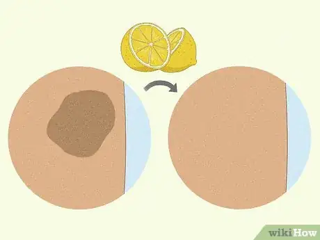 Image intitulée Use a Lemon to Lighten Your Skin Step 2