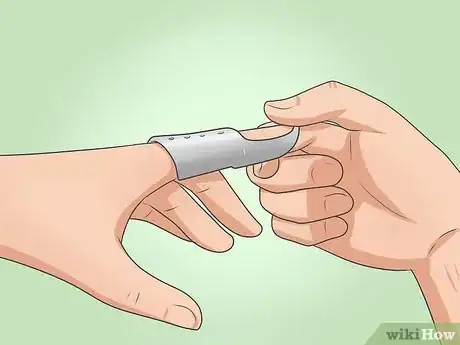 Image intitulée Splint Trigger Finger Step 11