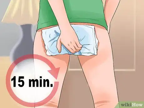 Image intitulée Stop Hemorrhoids from Itching Step 2