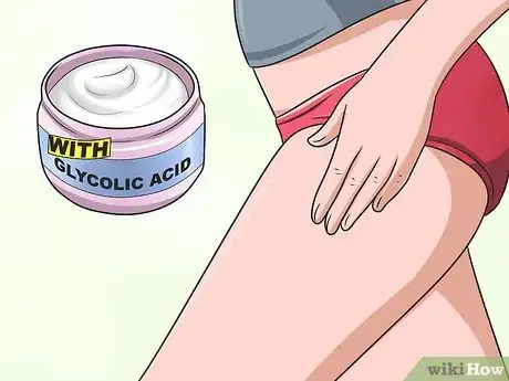 Image intitulée Get Rid of Stretch Marks Fast Step 12