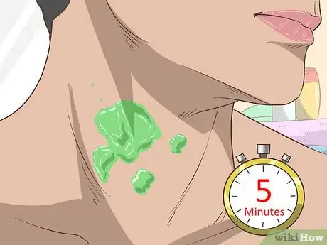 Image intitulée Get Rid of Neck Acne Step 10