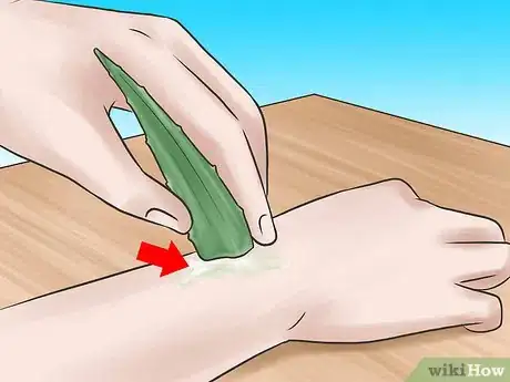 Image intitulée Use Aloe Vera for Acne Step 2