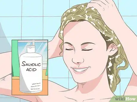 Image intitulée Heal Scalp Eczema Step 13