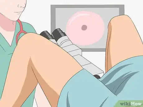 Image intitulée Recognize Implantation Bleeding Step 15