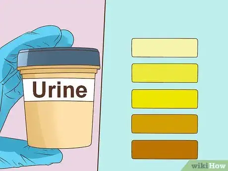 Image intitulée Identify Symptoms of Jaundice Step 7