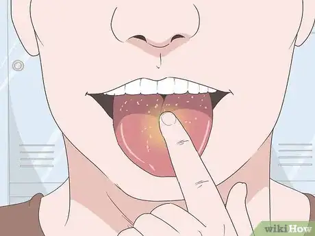 Image intitulée Heal Your Tongue After Eating Sour Candy Step 1