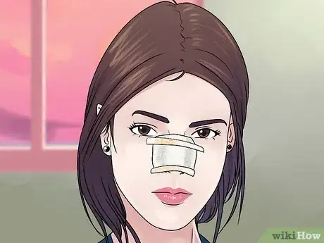 Image intitulée Reduce Swelling After Rhinoplasty Step 11