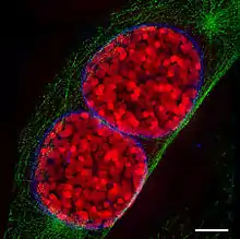 Two mouse cell nuclei in prophase.