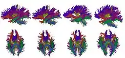 High-dimensional white matter atlas generation and group analysis: result of automatic segmentation of novel subjects.