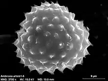 Pollen grain (scanning electron microscope)