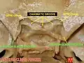 Anterior clinoid process